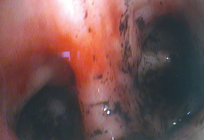 20º Congresso Nacional de Medicina Interna