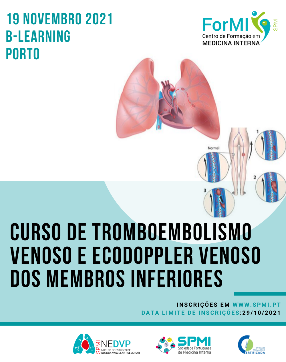 Curso De Tromboembolismo Venoso E Ecodoppler Venoso Spmi Porn Sex Picture