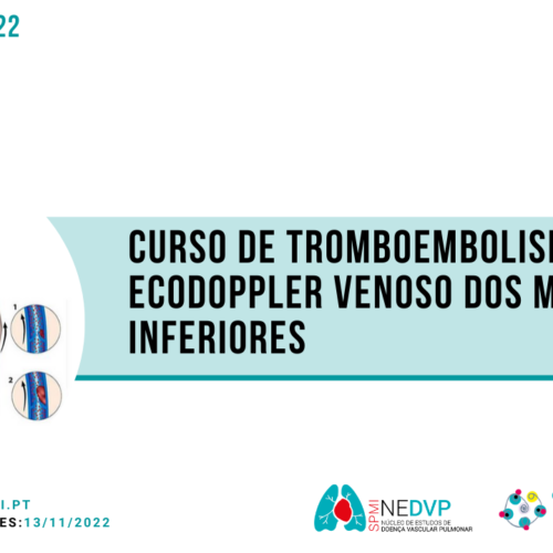 Curso de Tromboembolismo Venoso e Ecodoppler Venoso dos Membros Inferiores