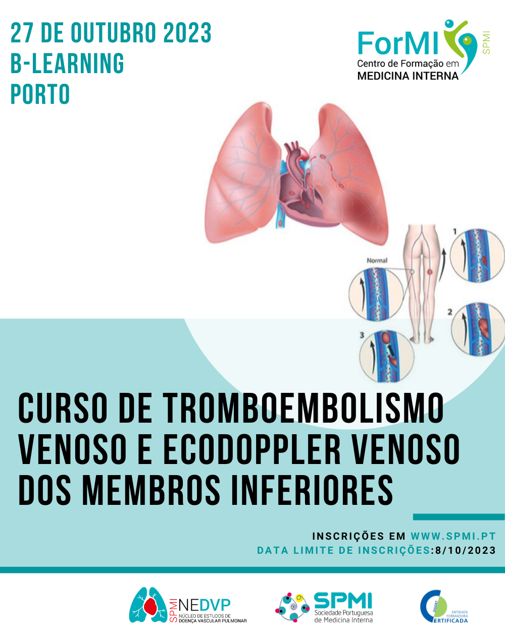 Curso Tromboembolismo Venoso (4)