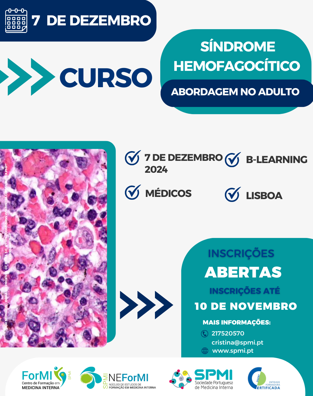 Curso Síndroma Hemofagocítico