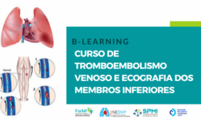 Curso de Tromboembolismo Venoso e Ecografia dos Membros Inferiores | 27 Fev 2026