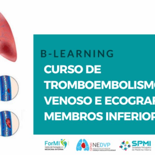 Curso de Tromboembolismo Venoso e Ecografia dos Membros Inferiores | 27 Fev 2026
