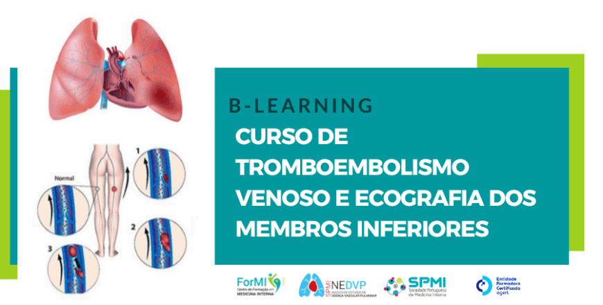 Curso de Tromboembolismo Venoso e Ecografia dos Membros Inferiores Curso de Tromboembolismo Venoso e Ecografia dos Membros Inferiores