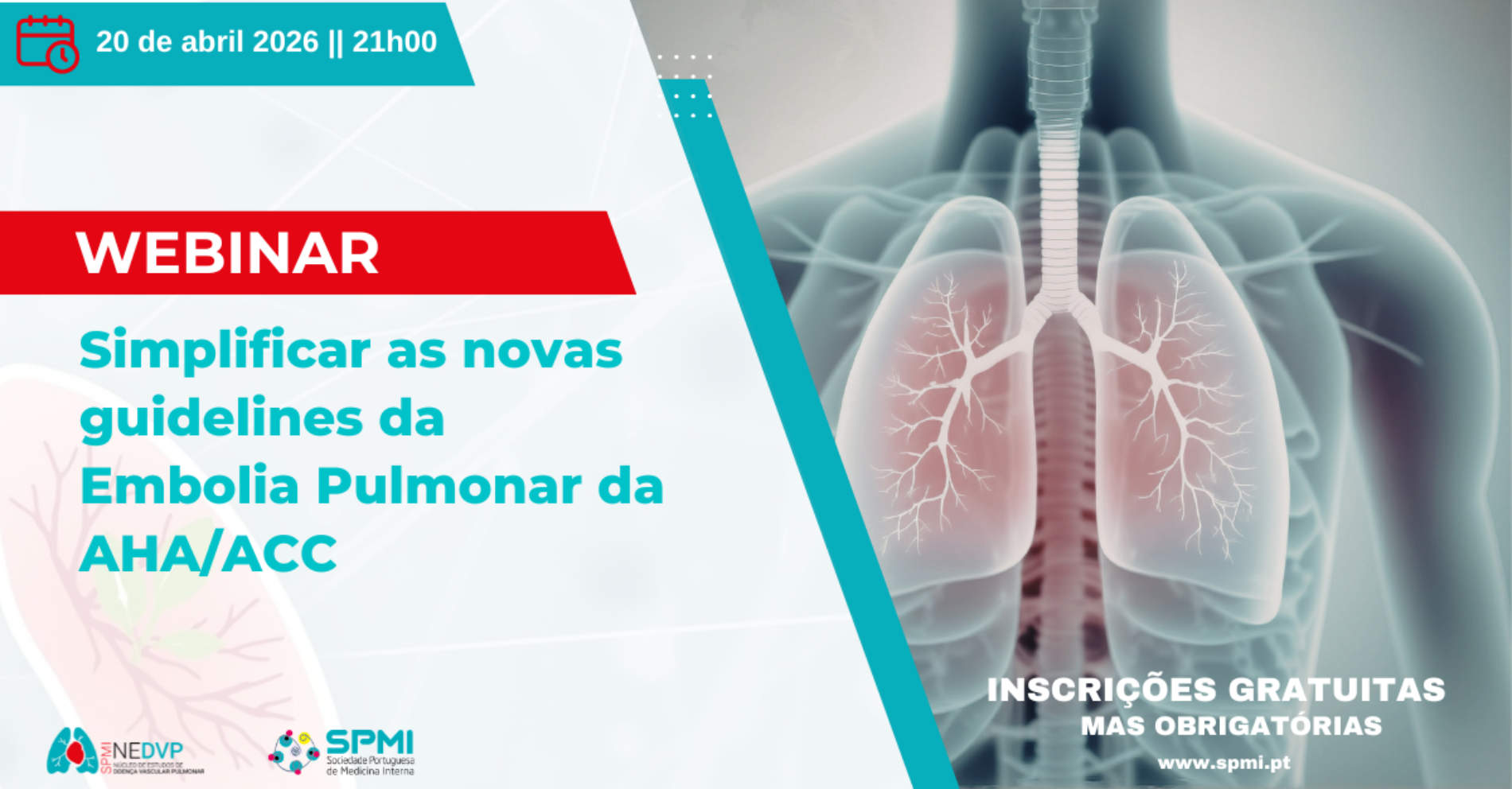 Webinar Simplificar as novas guidelines da Embolia Pulmonar da AHA/ACC