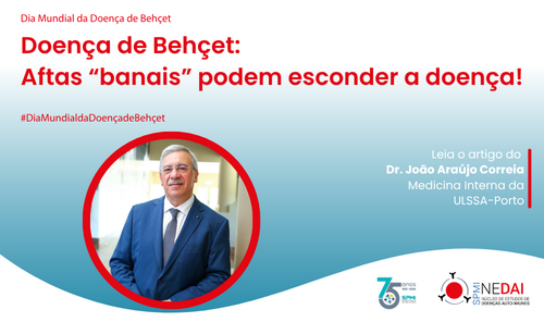 Doença de Behçet: Aftas “banais” podem esconder a doença!