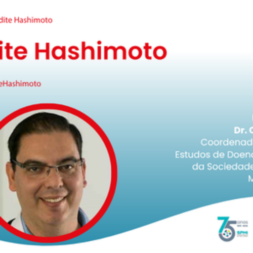 Tiroidite de Hashimoto