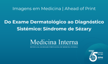 Do Exame Dermatológico ao Diagnóstico Sistémico: Síndrome de Sézary