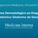 Do Exame Dermatológico ao Diagnóstico Sistémico: Síndrome de Sézary