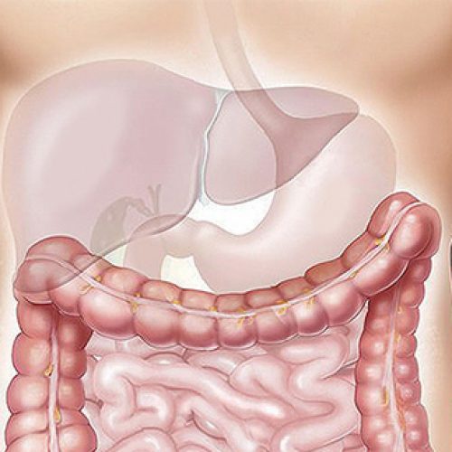 Curso Cirrose e suas complicações